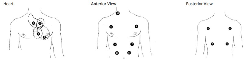 Graphic of cardionics simscope programming